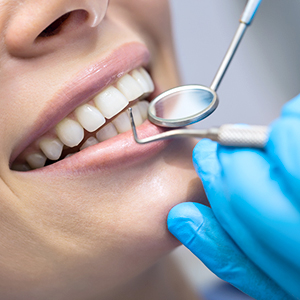 dental clinic Kondapur Hyderabad